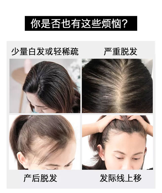 直垂发(图2)